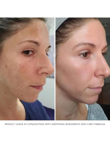 Hidratante Facial Bioelements 70g - Ligero y Vegano