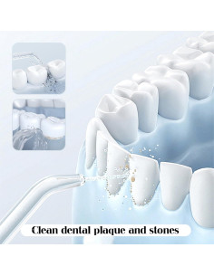 Puntas de Reemplazo Quacc para Irrigador Bucal WaterPik - 2 Pcs 2