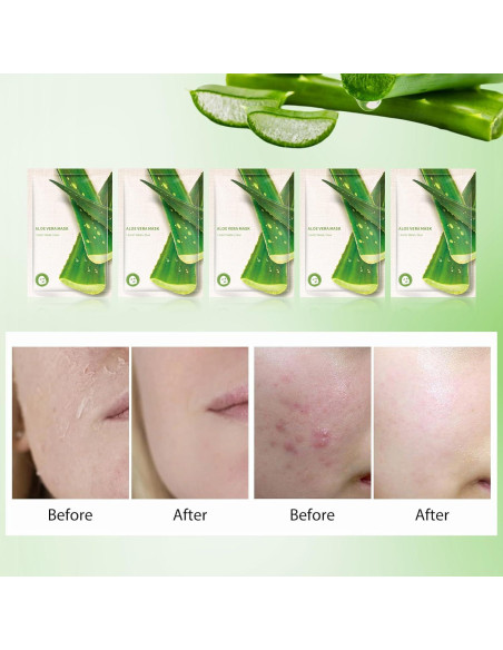 Mascarillas Faciales Hidratantes GUOYAOLIFU Aloe Vera - 5 Paquetes Mascarillas Faciales Hidratantes GUOYAOLIFU Aloe Vera - 5 Paquetes