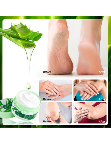 Crema de Urea 42% con Ácido Salicílico y Aloe Vera 198g
