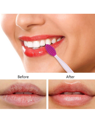 9 Cepillos Exfoliantes de Labios de Silicona 2 en 1 acDesign