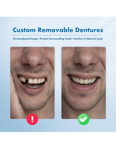 Dentaduras Removibles Personalizadas Qiivosm - 2 Dientes