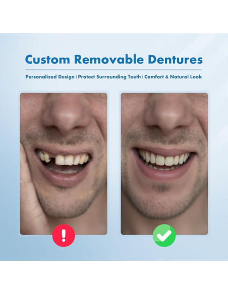 Dentaduras Removibles Personalizadas Qiivosm - 2 Dientes Dentaduras Removibles Personalizadas Qiivosm - 2 Dientes