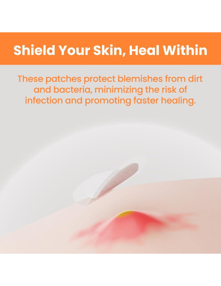 Parches Hydrocolloid Patchology Not A Spot - 48 Adhesivos para Acné Parches Hydrocolloid Patchology Not A Spot - 48 Adhesivos para Acné