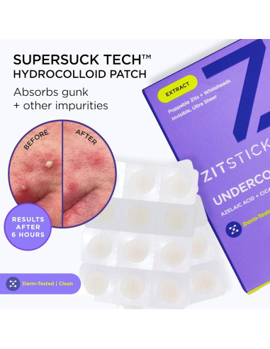 Parche Hidrocoloide ZitSticka UNDERCOVER 108ct para Granitos
