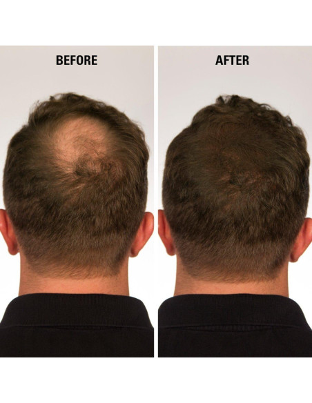 Fibras para Cabello ECLIPSE Rubio Oscuro 15g Indetectables Fibras para Cabello ECLIPSE Rubio Oscuro 15g Indetectables
