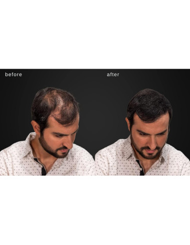 Fibras Engrosadoras para Cabello LUXE 25g Color Negro