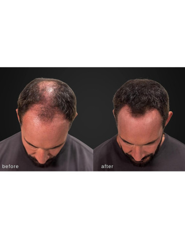 Fibras Engrosadoras para Cabello LUXE 25g Color Negro