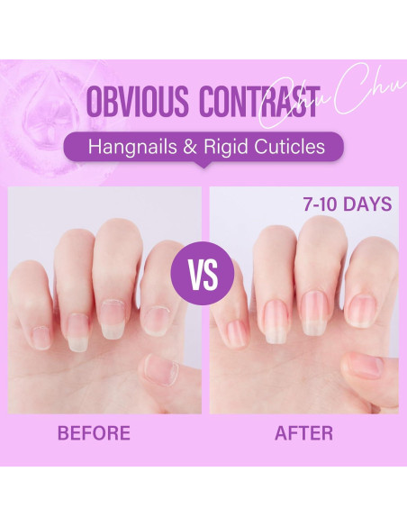 Aceite Orgánico para Cutículas CHUCHU 15ml - Jojoba y Vitaminas Aceite Orgánico para Cutículas CHUCHU 15ml - Jojoba y Vitaminas