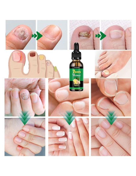 Suero de Crecimiento de Uñas de Jengibre Jewsuva 30 ml (2 Piezas) Suero de Crecimiento de Uñas de Jengibre Jewsuva 30 ml (2 Piezas)