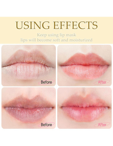 30 Mascarillas Hidratantes de Gel Minfei para Labios y Ojos