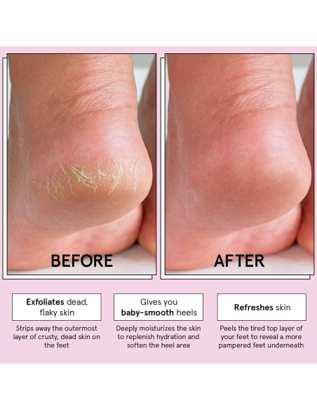 Mascarilla Exfoliante para Pies Grace & Stella - 4 Pares Sin Fragancia Mascarilla Exfoliante para Pies Grace & Stella - 4 Pares Sin Fragancia