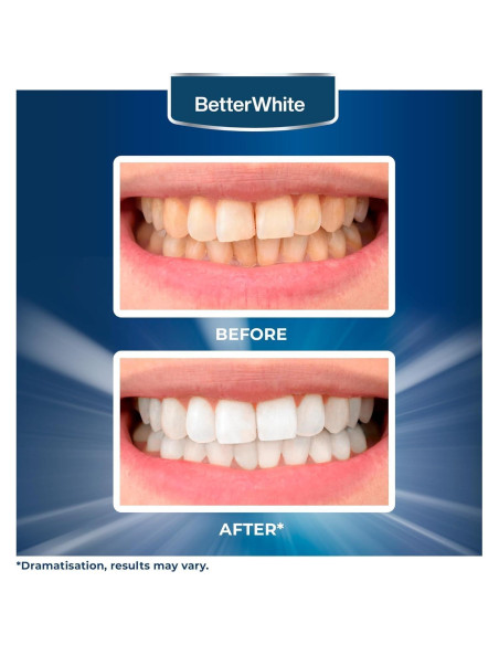 Tiras de Blanqueamiento Dental BetterWhite - 14 Tiras Naturales Tiras de Blanqueamiento Dental BetterWhite - 14 Tiras Naturales