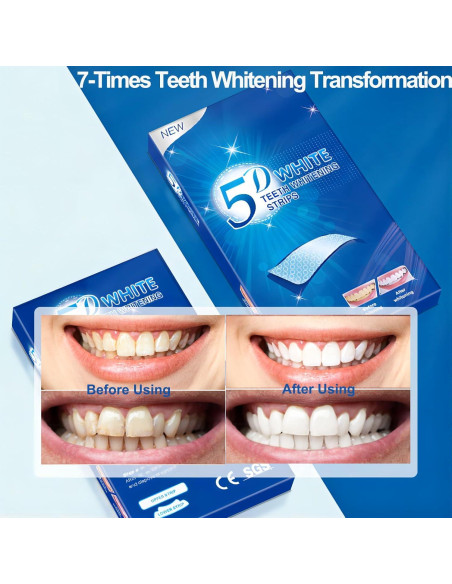 Kit de Tiras Blanqueadoras de Dientes Keepzi - 28 Piezas, Sin Sensibilidad Kit de Tiras Blanqueadoras de Dientes Keepzi - 28 Piezas, Sin Sensibilidad