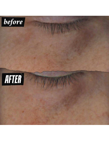 Sérum para Ojos Kiehl's Vitamina C 10% 14.79 ml