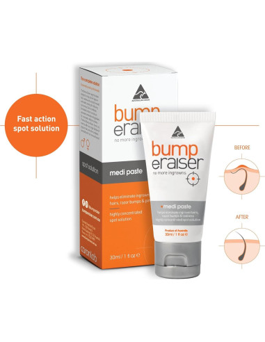 Pasta Medi Bump eRaiser 30g para vellos encarnados y bultos