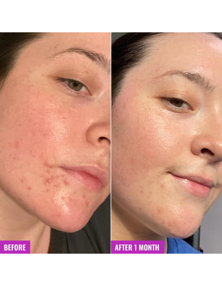 Barra de Limpieza Good Molecules 89g - Sin Jabón, Ácido Salicílico