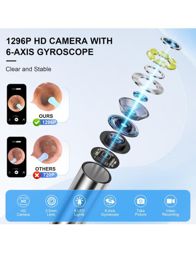 Kit Limpiador de Oídos Inalámbrico Keyloland con Cámara HD
