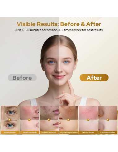 Máscara de Terapia de Luz Roja COSYBEE 280 LED 8 Modos Antienvejecimiento