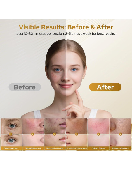 Máscara de Terapia de Luz Roja COSYBEE 280 LED 8 Modos Antienvejecimiento Máscara de Terapia de Luz Roja COSYBEE 280 LED 8 Modos Antienvejecimiento