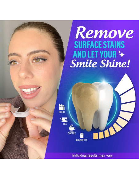 Bandejas de Blanqueamiento Dental GuruNanda 8% Peróxido 7 Tratamientos Bandejas de Blanqueamiento Dental GuruNanda 8% Peróxido 7 Tratamientos