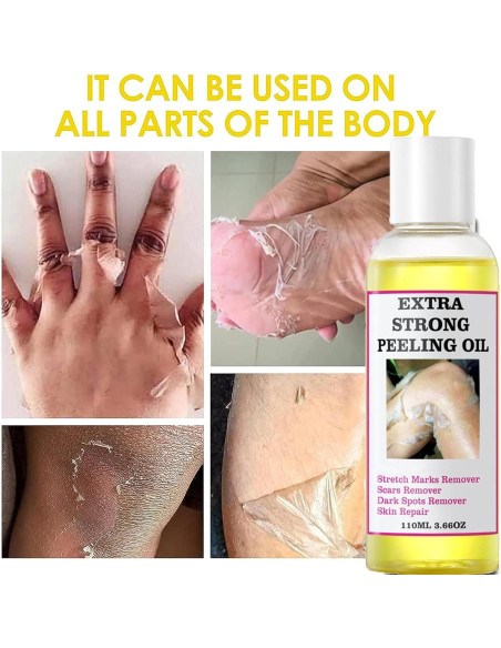 Aceite Exfoliante Amarillo Genérico 110ml - Todo Tipo de Piel Aceite Exfoliante Amarillo Genérico 110ml - Todo Tipo de Piel