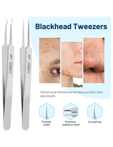 Juego de Pinzas WSYUB para Puntos Negros y Vello Encarnado Juego de Pinzas WSYUB para Puntos Negros y Vello Encarnado