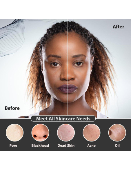 Cepillo Facial Eléctrico SC Chocolate 3-en-1 Impermeable Negro Cepillo Facial Eléctrico SC Chocolate 3-en-1 Impermeable Negro
