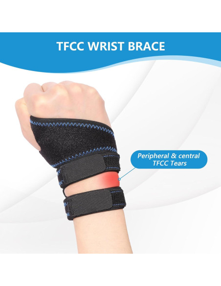 Muñequera Ajustable TFCC Joingood - Talla Única Azul Muñequera Ajustable TFCC Joingood - Talla Única Azul