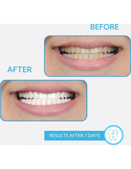 Bolígrafo Blanqueador GO SMILE 1.3mL para Dientes Blancos Bolígrafo Blanqueador GO SMILE 1.3mL para Dientes Blancos