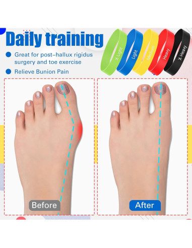 Juego de 5 Bandas de Estiramiento para Dedos WinnerWhy