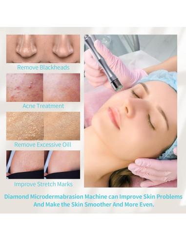 Máquina de Microdermoabrasión REEOH 2 en 1 Facial Profesional