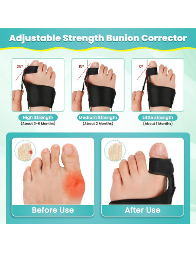 Corrector de Juanetes CEYOME - Férula Ajustable y Almohadillas de Silicona
