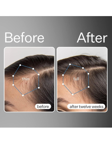 Suero de Células Madre Act+Acre 29.57 ml - Hidrata y Nutre Cabello