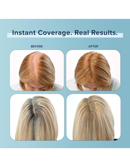 TRUHAIR Fibras de Color Negro para Cobertura de Raíces 4.5g TRUHAIR Fibras de Color Negro para Cobertura de Raíces 4.5g