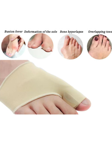 Corrector de Juanetes Hygger con Almohadillas de Gel - Beige