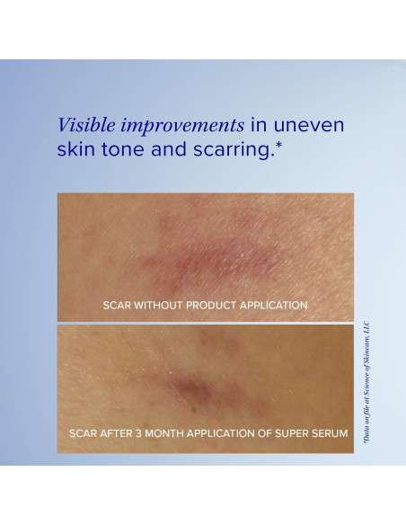 Suero Facial iS CLINICAL Super Avanzado+ 29.57 ml Vitamina C Suero Facial iS CLINICAL Super Avanzado+ 29.57 ml Vitamina C