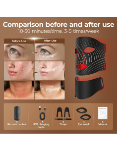 Máscara de Terapia de Luz Roja ONLUKY 103 Perlas LED para Cara y Cuello 2