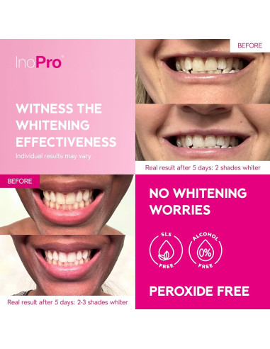 Kit 14 Tiras Blanqueadoras Dientes Smile&Shine Sin Peróxido