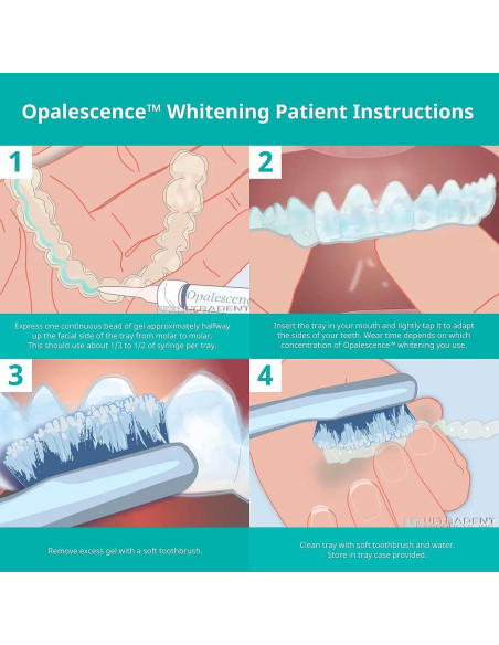 Kit de Blanqueamiento Dental Opalescence 20% - Ultradent - 4 Jeringas Kit de Blanqueamiento Dental Opalescence 20% - Ultradent - 4 Jeringas
