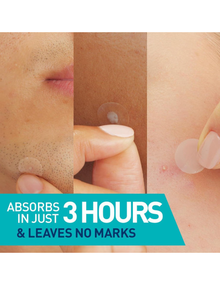 Parches Hidrocoloides CeraVe para Imperfecciones 22ct Parches Hidrocoloides CeraVe para Imperfecciones 22ct