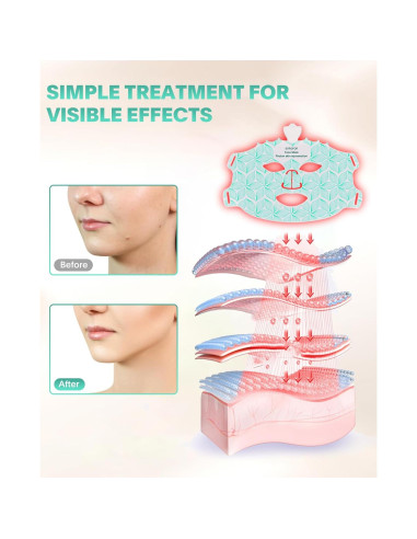 Máscara de Terapia de Luz LED 7 Colores EVFOFO para Facial