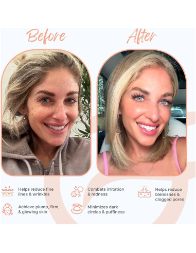 Máscara LED Groomie GlowUp - Terapia Facial 6 Modos Antienvejecimiento