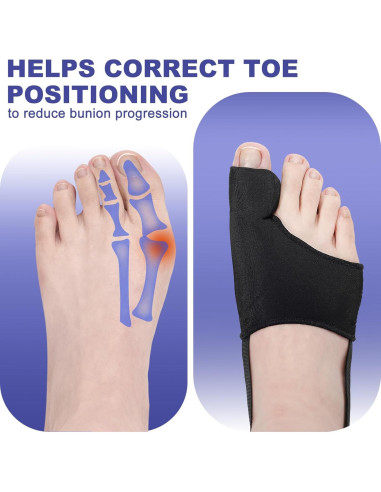 Corrector de Juanetes CLEANET para Alivio de Hallux Valgus