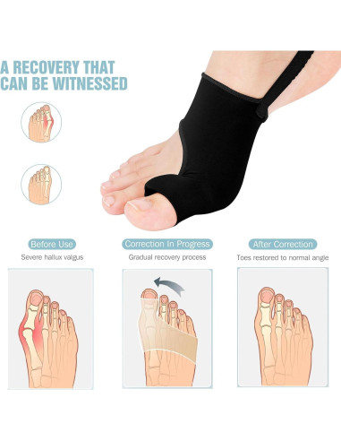 Corrector de Juanetes WELEQUT 2-Pack Alivio Hallux Valgus Negro
