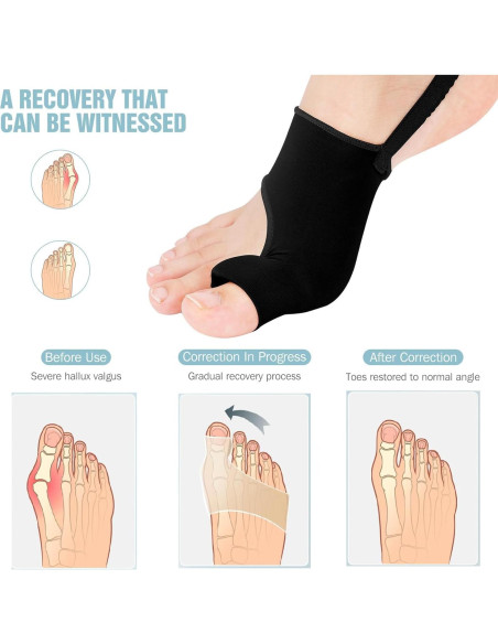 Corrector de Juanetes WELEQUT 2-Pack Alivio Hallux Valgus Negro Corrector de Juanetes WELEQUT 2-Pack Alivio Hallux Valgus Negro