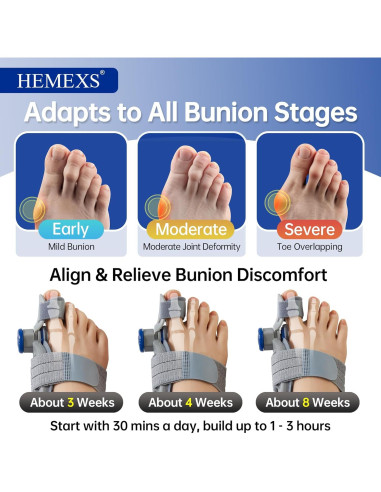 Corrector de Juanetes Hemexs KY-BC-01 Ajustable para Dedo Gordo