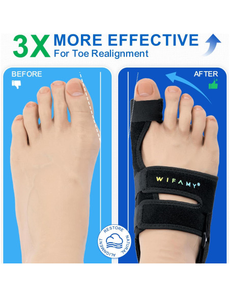 Corrector de Juanetes Wifamy para Dedo Gordo - Alivio del Dolor Corrector de Juanetes Wifamy para Dedo Gordo - Alivio del Dolor
