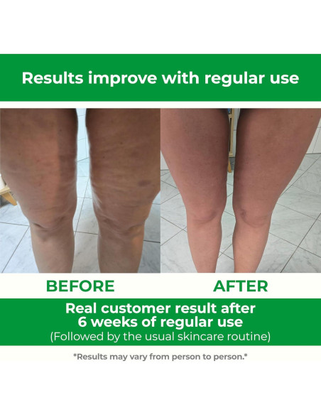 Masajador Manual Anticelulitis TESMED Rose - Hecho en Italia Masajador Manual Anticelulitis TESMED Rose - Hecho en Italia
