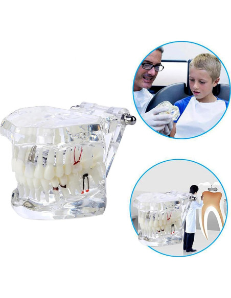 Modelo Dental Typodont Implantológico Dentalmall 2001C Modelo Dental Typodont Implantológico Dentalmall 2001C